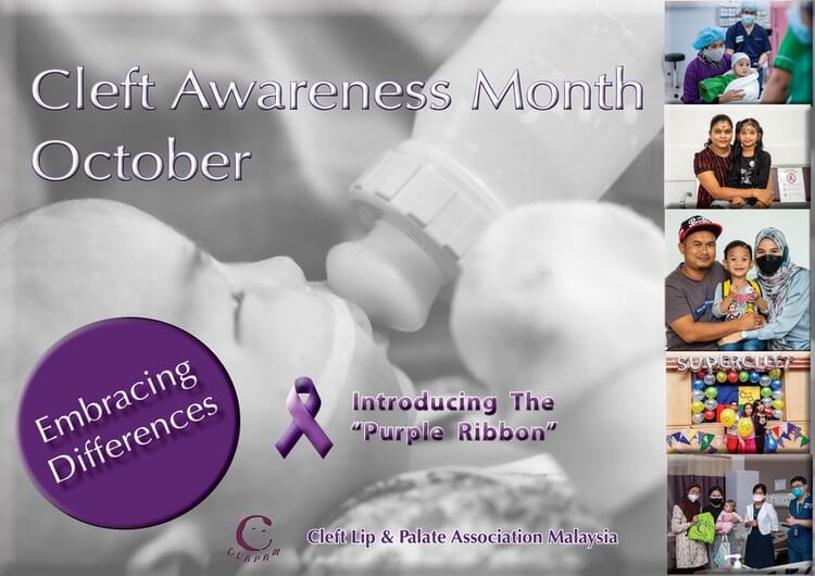 Gazetting October as the Cleft Awareness Month CLAPAM